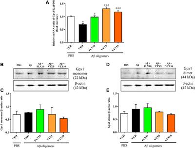 Antioxidant Activity of Fluoxetine and Vortioxetine in a Non-Transgenic Animal Model of Alzheimer’s Disease